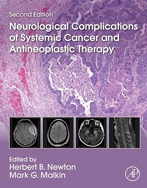 Téléchargez le livre :  Neurological Complications of Systemic Cancer and Antineoplastic Therapy
