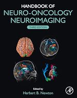 Télécharger le livre :  Handbook of Neuro-Oncology Neuroimaging