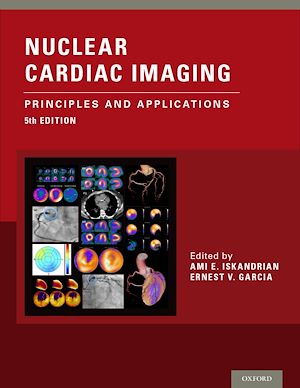 Download the eBook: Nuclear Cardiac Imaging