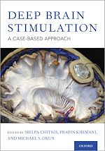 Télécharger le livre :  Deep Brain Stimulation