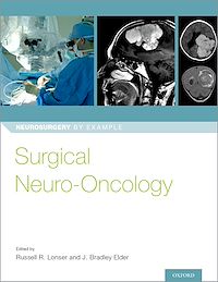 Téléchargez le livre :  Surgical Neuro-Oncology