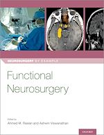 Télécharger le livre :  Functional Neurosurgery