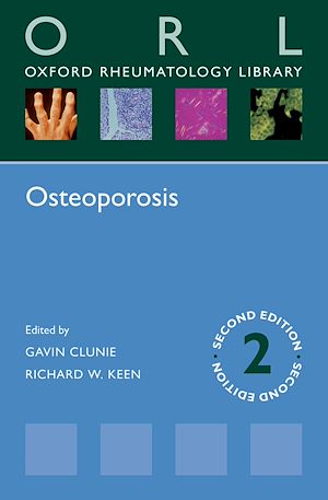 Téléchargez le livre :  Osteoporosis
