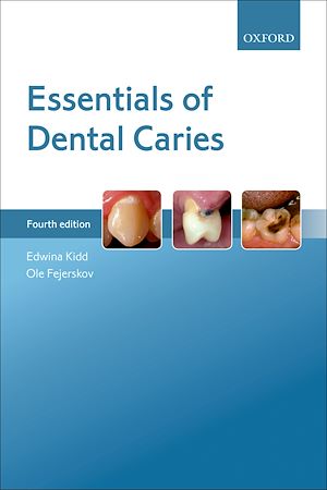 Téléchargez le livre :  Essentials of Dental Caries