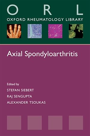 Téléchargez le livre :  Axial Spondyloarthritis