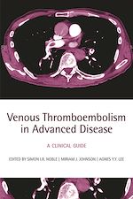Télécharger le livre :  Venous Thromboembolism in Advanced Disease