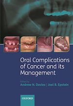 Télécharger le livre :  Oral Complications of Cancer and its Management