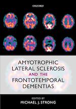 Télécharger le livre :  Amyotrophic Lateral Sclerosis and the Frontotemporal Dementias