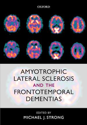 Téléchargez le livre :  Amyotrophic Lateral Sclerosis and the Frontotemporal Dementias