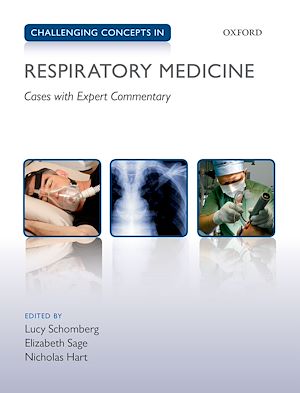 Téléchargez le livre :  Challenging Concepts in Respiratory Medicine