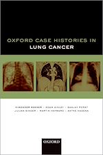 Télécharger le livre :  Oxford Case Histories in Lung Cancer