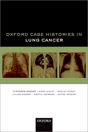 Téléchargez le livre :  Oxford Case Histories in Lung Cancer