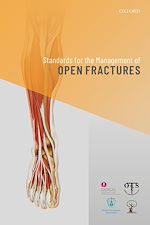 Télécharger le livre :  Standards for the Management of Open Fractures