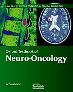 Télécharger le livre :  Oxford Textbook of Neuro-Oncology