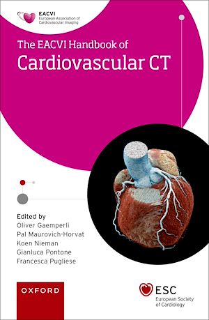 Télécharger le livre :  EACVI Handbook of Cardiovascular CT