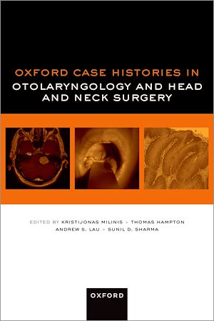 Téléchargez le livre :  Oxford Case Histories in Otolaryngology and Head and Neck Surgery