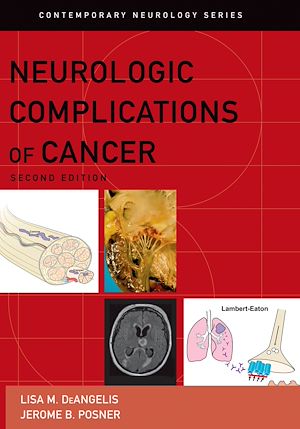 Téléchargez le livre :  Neurologic Complications of Cancer