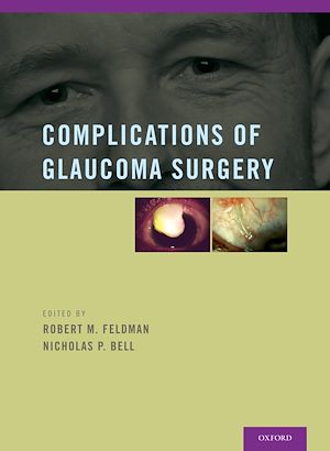 Téléchargez le livre :  Complications of Glaucoma Surgery