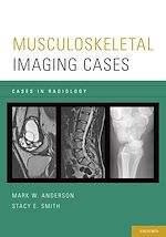 Télécharger le livre :  Musculoskeletal Imaging Cases