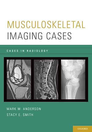 Téléchargez le livre :  Musculoskeletal Imaging Cases
