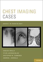 Télécharger le livre :  Chest Imaging Cases