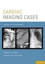 Télécharger le livre :  Cardiac Imaging Cases