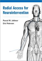 Télécharger le livre :  Radial Access for Neurointervention