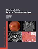 Télécharger le livre :  Mayo Clinic Cases in Neuroimmunology