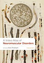 Download this eBook A Video Atlas of Neuromuscular Disorders