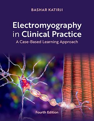 Téléchargez le livre :  Electromyography in Clinical Practice