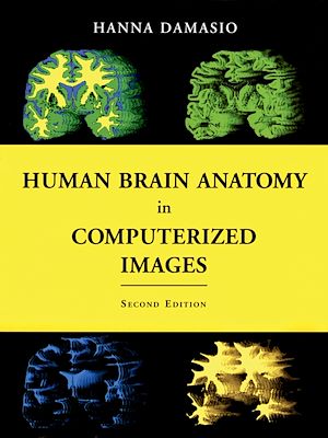 Téléchargez le livre :  Human Brain Anatomy in Computerized Images