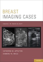 Télécharger le livre :  Breast Imaging Cases