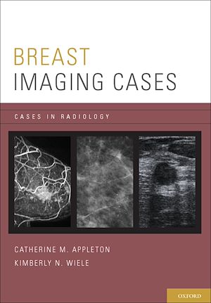 Téléchargez le livre :  Breast Imaging Cases