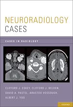 Télécharger le livre :  Neuroradiology Cases