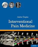 Télécharger le livre :  Interventional Pain Medicine