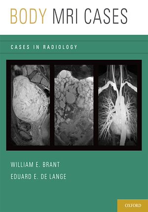 Téléchargez le livre :  Body MRI Cases