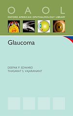 Télécharger le livre :  Glaucoma