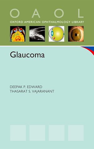 Téléchargez le livre :  Glaucoma