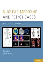 Télécharger le livre :  Nuclear Medicine and PET/CT Cases
