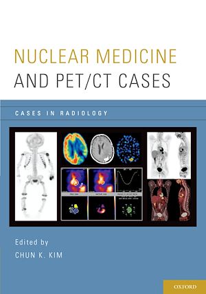 Téléchargez le livre :  Nuclear Medicine and PET/CT Cases