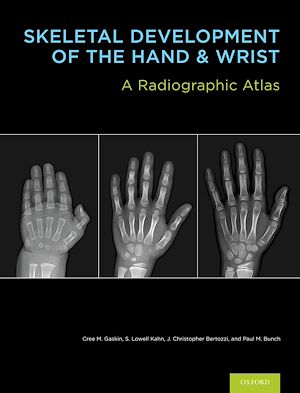 Téléchargez le livre :  Skeletal Development of the Hand and Wrist