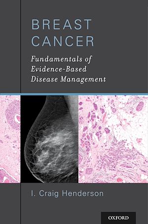 Téléchargez le livre :  Breast Cancer