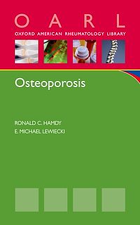 Téléchargez le livre :  Osteoporosis