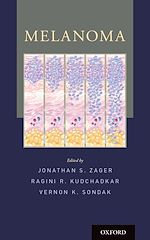 Télécharger le livre :  Melanoma