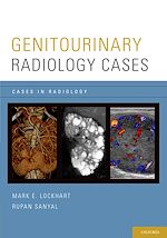 Télécharger le livre :  Genitourinary Radiology Cases