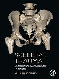 Téléchargez le livre :  Skeletal Trauma