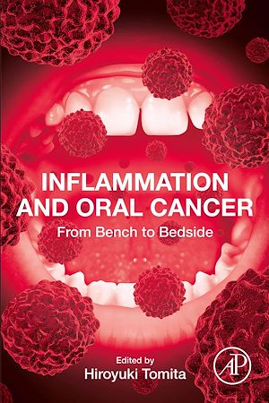 Download the eBook: Inflammation and Oral Cancer