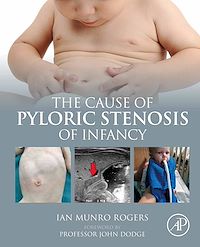 Téléchargez le livre :  The Cause of Pyloric Stenosis of Infancy