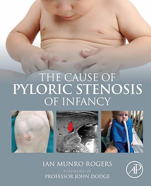 Téléchargez le livre :  The Cause of Pyloric Stenosis of Infancy