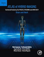 Télécharger le livre :  Atlas of Hybrid Imaging Sectional Anatomy for PET/CT, PET/MRI and SPECT/CT Vol. 1: Brain and Neck